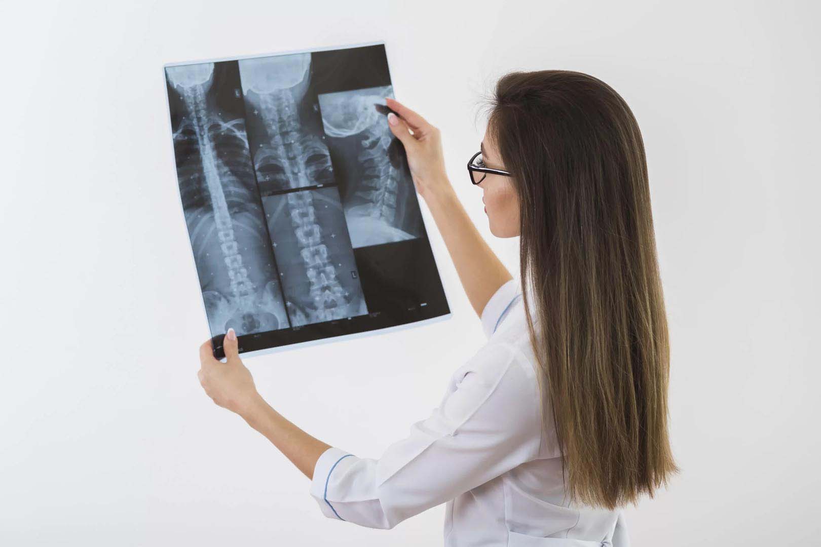 Gerincferd&uuml;l&eacute;s (scoliosis) kimutat&aacute;sa r&ouml;ntgenvizsg&aacute;lattal: gerincr&ouml;ntgen Debrecenben, a Medilumban