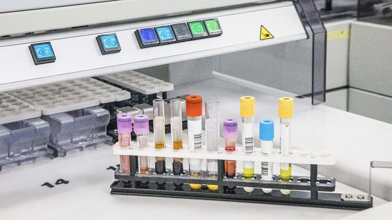 Nagylabor vizsg&aacute;lat &ndash; Amire &eacute;vente egy alkalommal mindenkinek sz&uuml;ks&eacute;ge lenne!