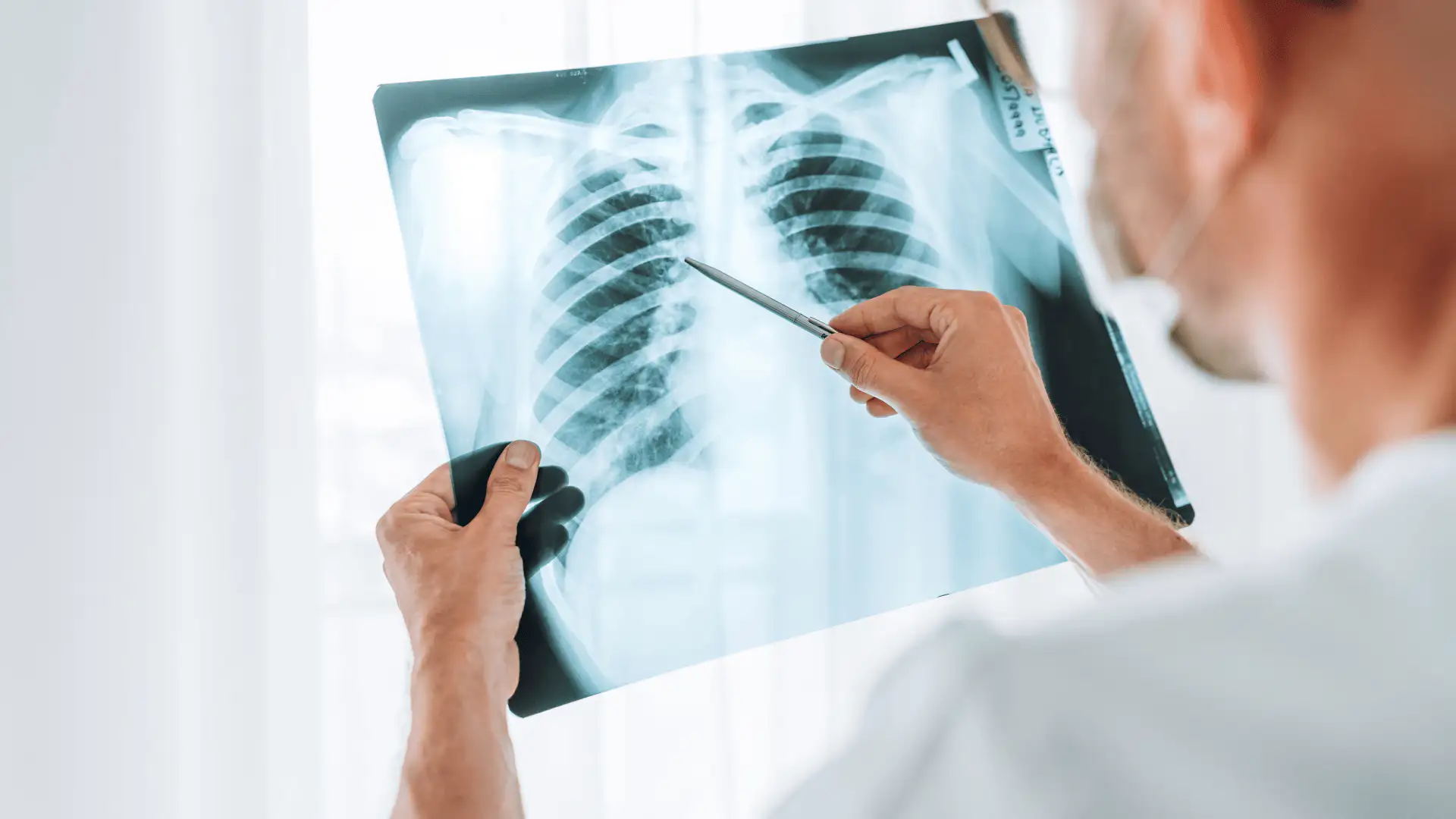 Röntgendiagnosztika: mikor és mire használjuk? 