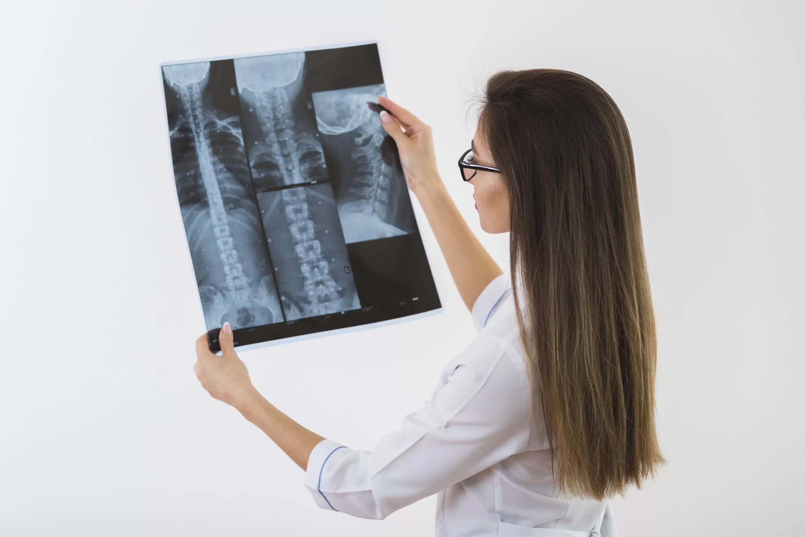 Gerincferdülés (scoliosis) kimutatása röntgenvizsgálattal: gerincröntgen Debrecenben, a Medilumban