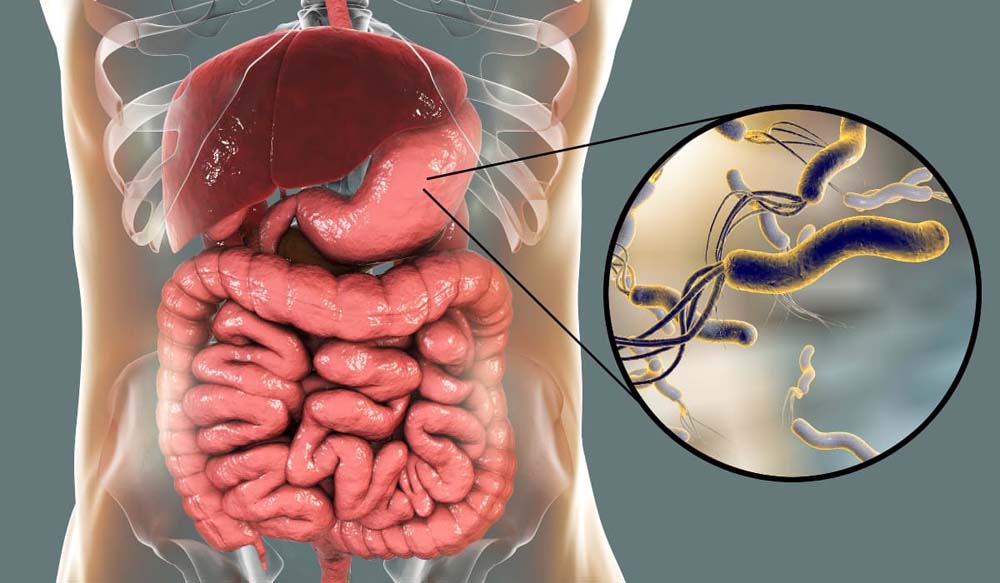 Helicobacter pylori kilégzési teszt