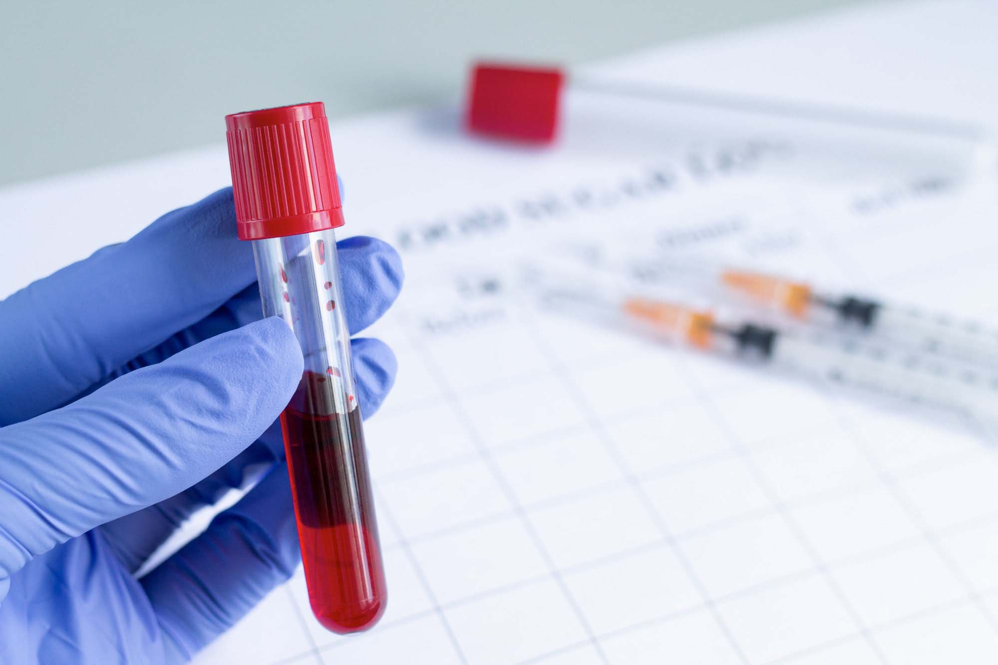 Laboratóriumi vizsgálatok