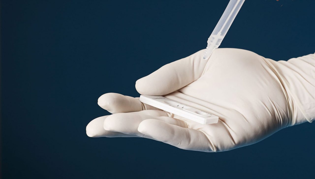 Covid19 antigéngyorsteszt Medilum Egészségközpont